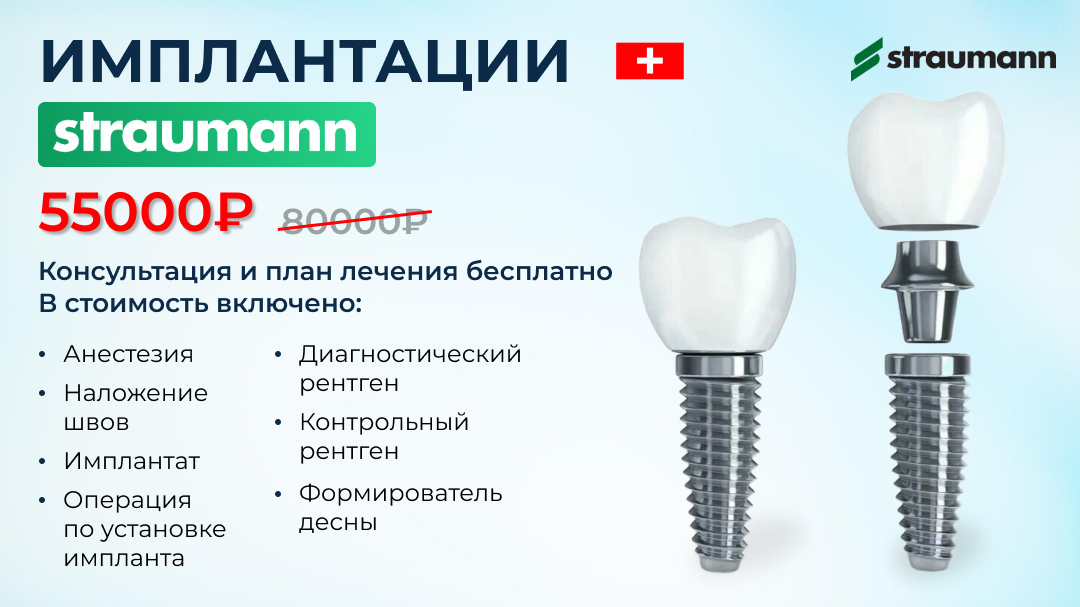 Имплантация зубов после 50 лет