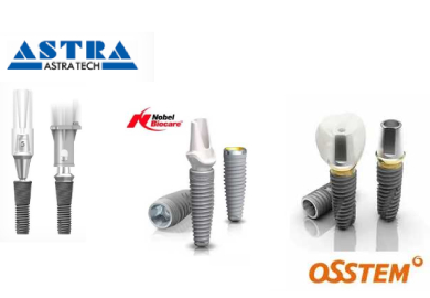 Как выбрать зубной имплант: Astra, Nobel или Osstem?