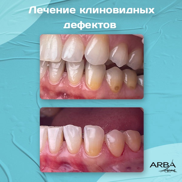 Результат лечения