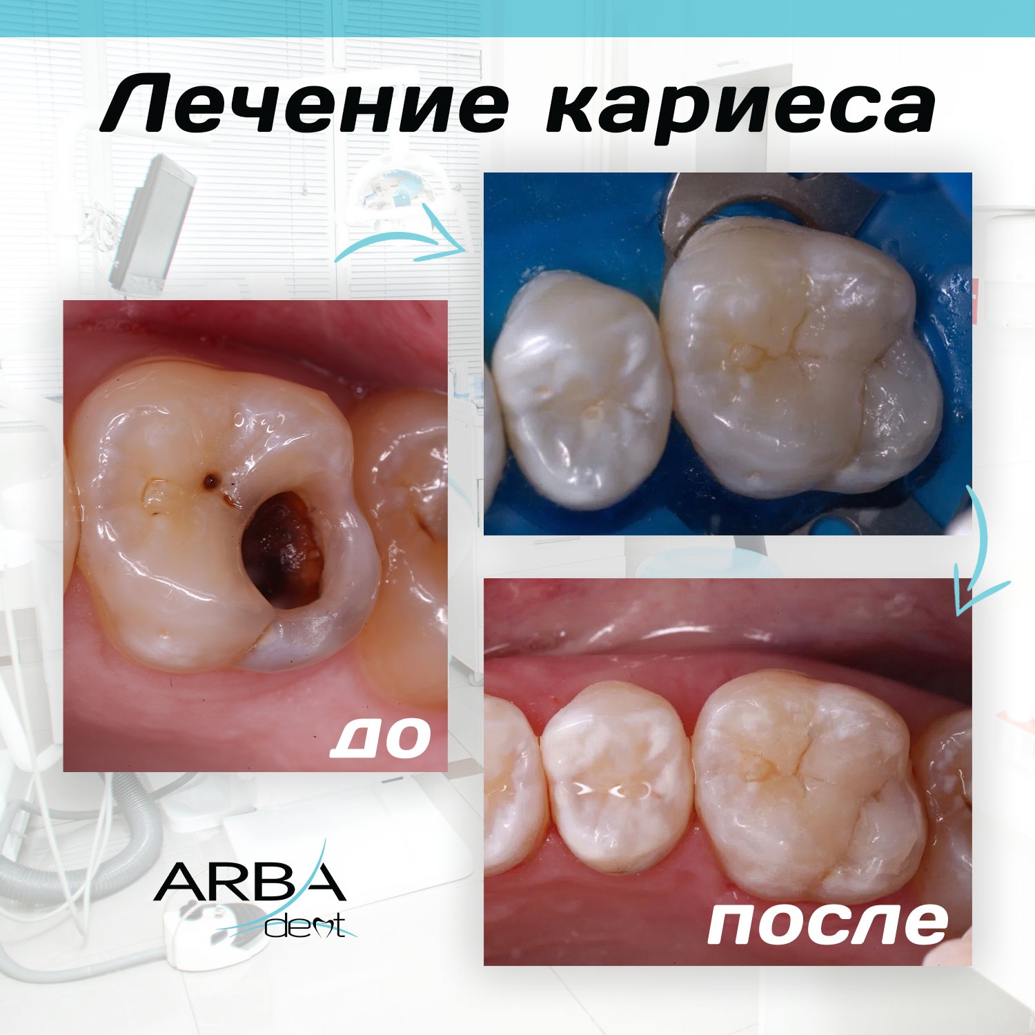 Результат лечения