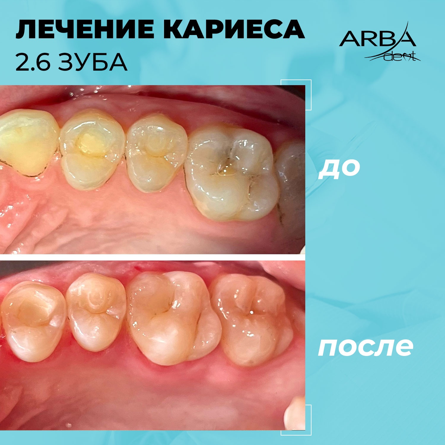 Результат лечения