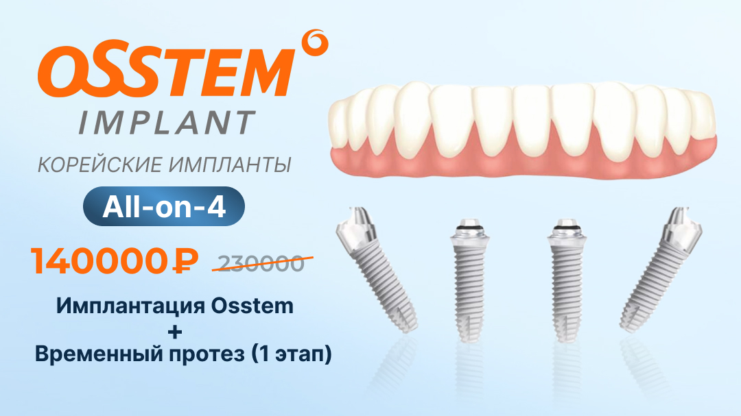 All-on-4 от Osstem