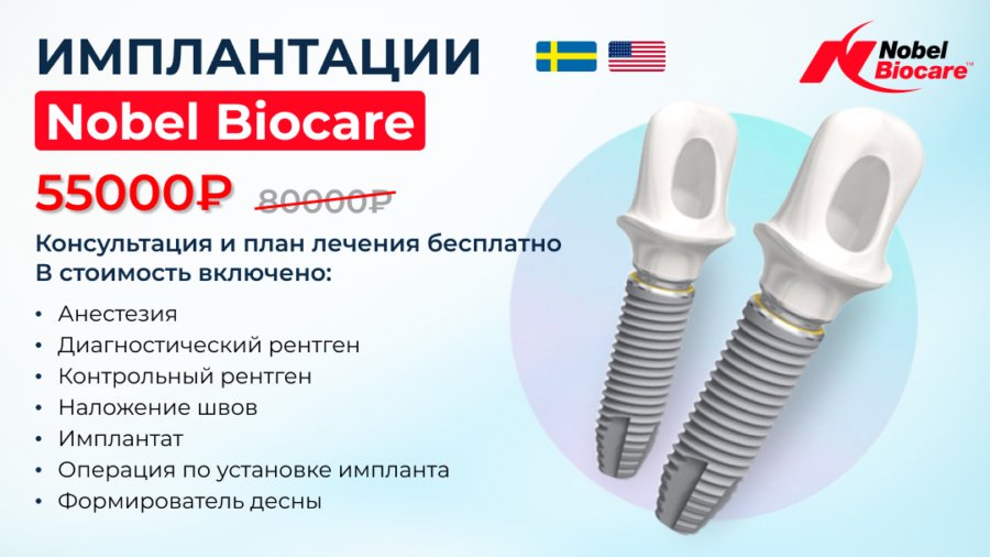 Имплант Nobel Biocare